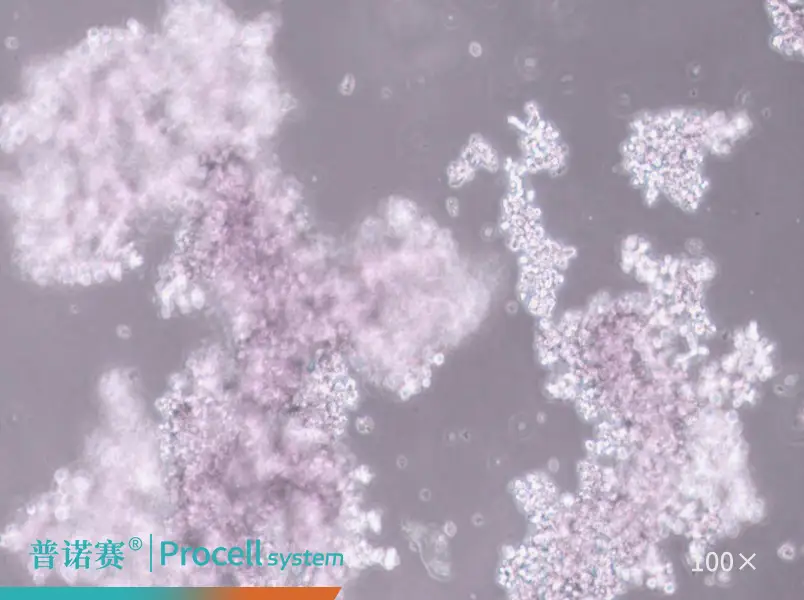 NCI-H660（人神经内分泌前列腺癌细胞）-细胞系-武汉普诺赛生命科技有限公司