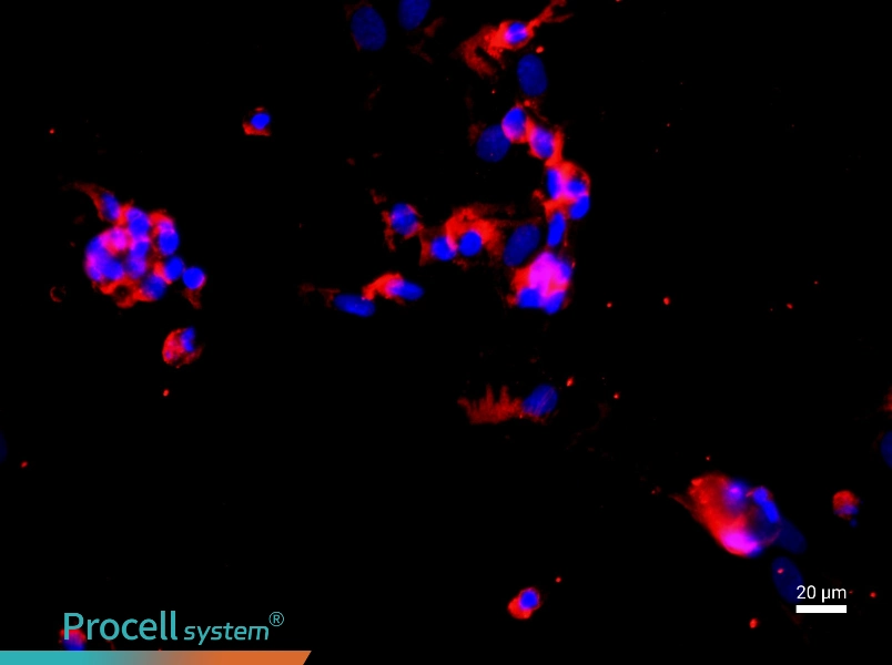 Human Pulmonary Great Artery Endothelial Cell Complete Medium - 2