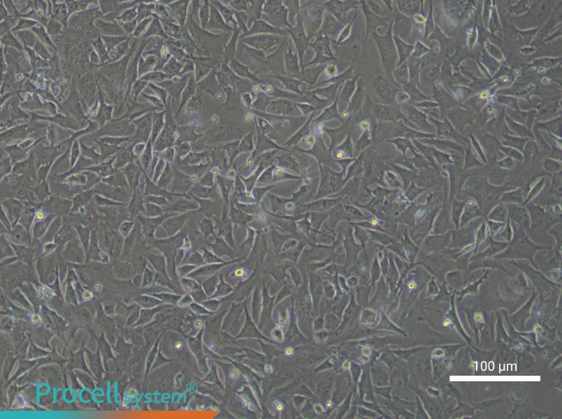 Mouse Cardiac Microvascular PericytesMouse Cardiac Microvascular Pericytes - 2