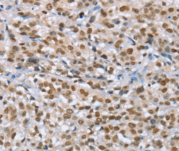 MCM6 Polyclonal Antibody - 2