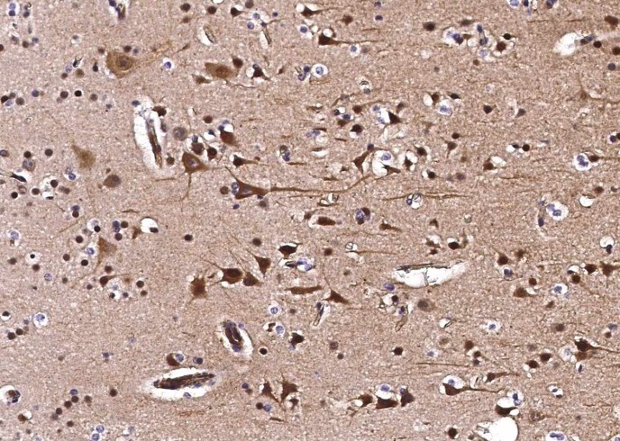 Recombinant CIB2 Monoclonal Antibody - small - 2