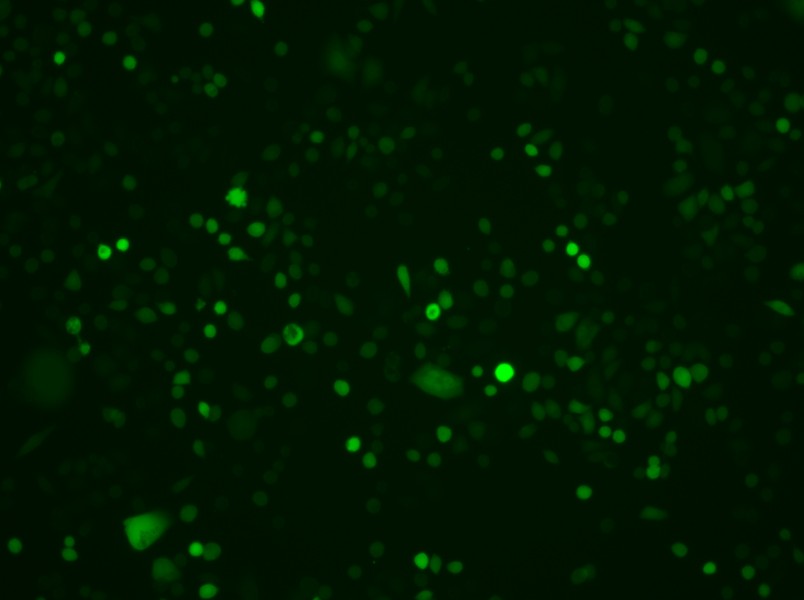 AGS-LUC-EGFP Cell Complete Medium - 2