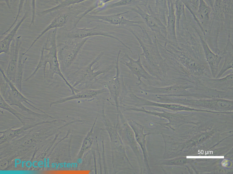 Human Aortic Adventitial Fibroblast Complete Medium - 4