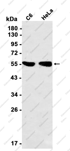 Recombinant Keratin 4 Monoclonal Antibody - 1