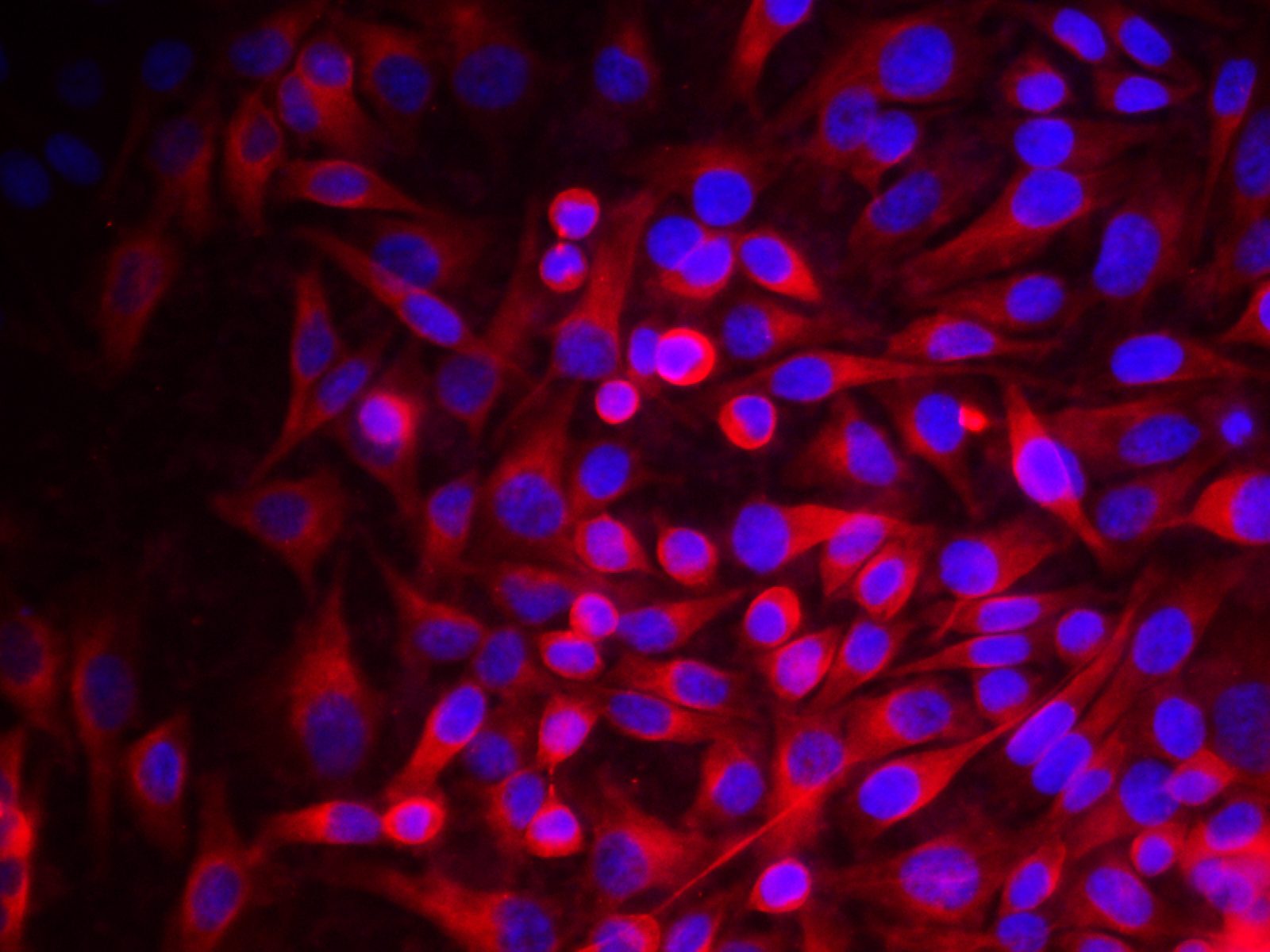 beta Tubulin Monoclonal Antibody - 3