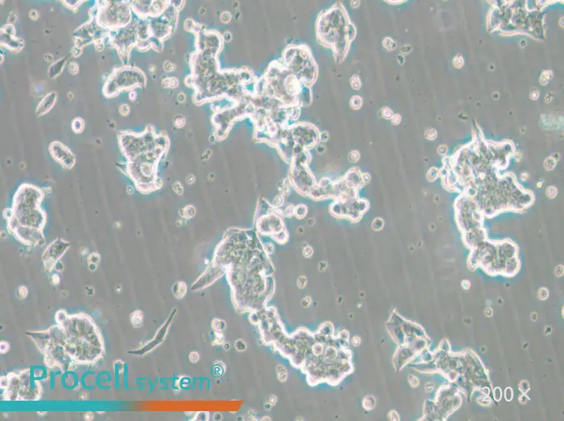 NCI-H209 [H209] Cell Complete Medium - small - 5