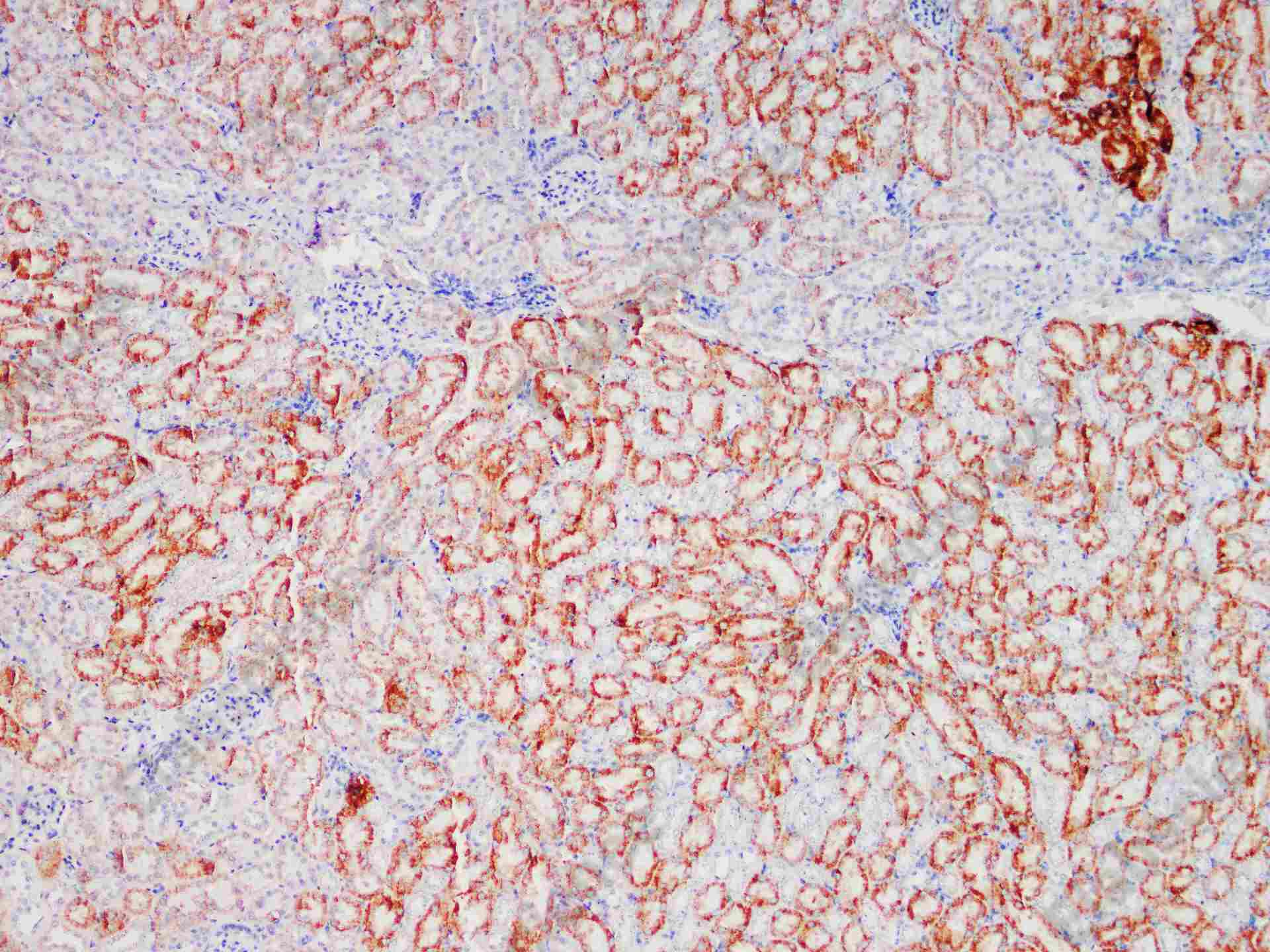 Recombinant ACOX1/AOX Monoclonal Antibody - 1