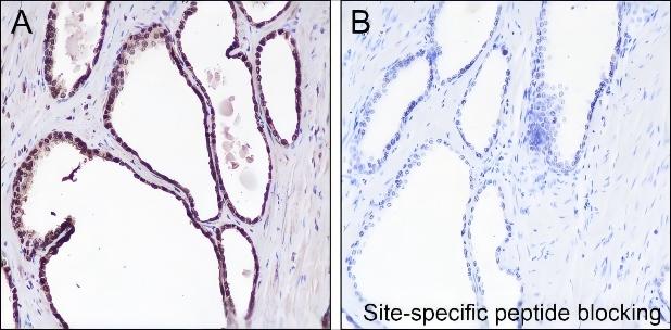 Recombinant Histone H4 (Mono Methyl Lys12) Monoclonal Antibody - 3