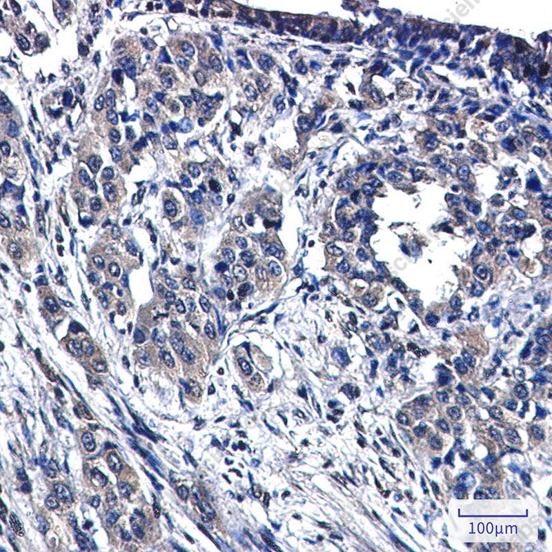 Recombinant MAP3K4 Monoclonal Antibody - 2