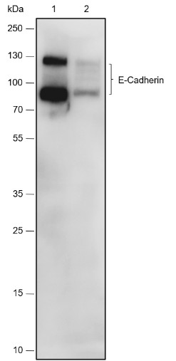 Recombinant E-Cadherin Monoclonal Antibody - 2