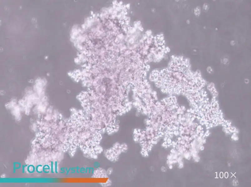 NCI-H660 Cell Complete Medium - 1