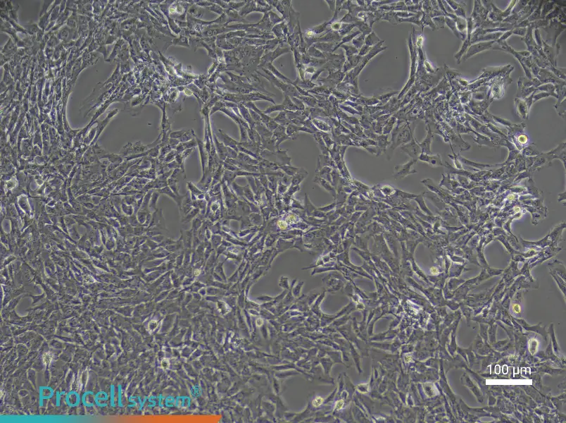 Rat Coronary Artery Smooth Muscle Cell Complete Medium - 2