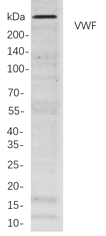 Recombinant VWF Monoclonal Antibody-searchlist-1