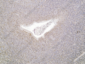 Recombinant Bcl-w Monoclonal Antibody - 1