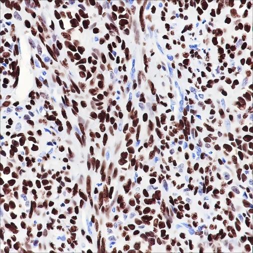 Recombinant FOXL2 Monoclonal Antibody - 2