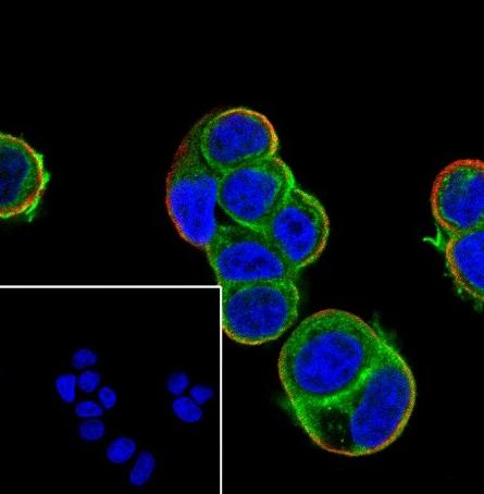 Recombinant Gelsolin Monoclonal Antibody - 3