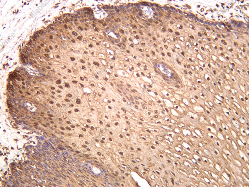 Recombinant IL-1RA Monoclonal Antibody - 2