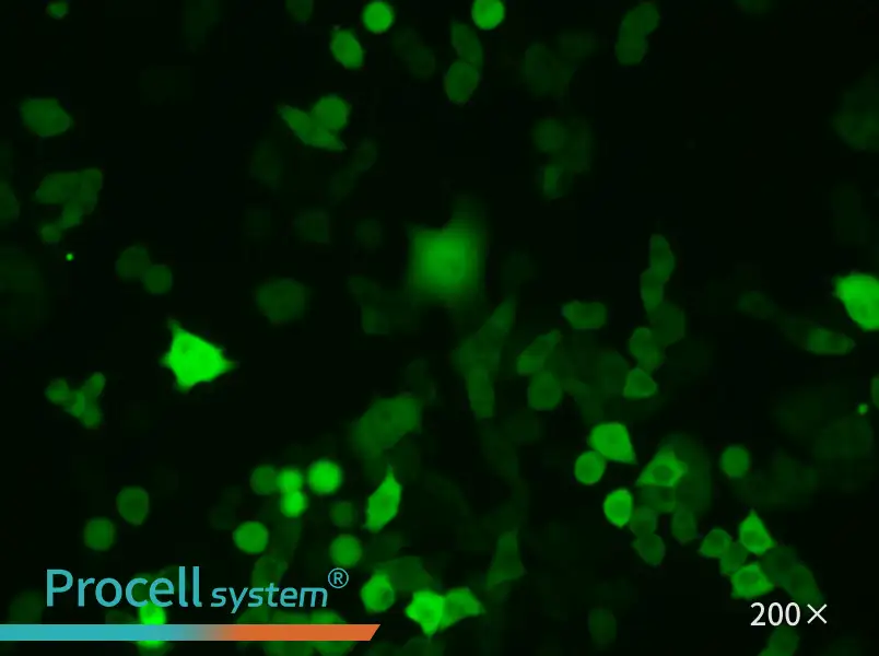 4T1-GFP - 6