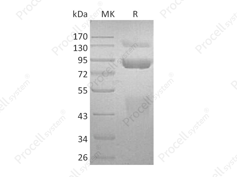 HGF R/c-Met/HGFR, Human, Recombinant