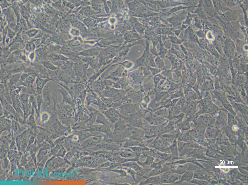 Mouse Dermal Fibroblasts (Primary cell immortalization)Mouse Dermal Fibroblasts (Primary cell immortalization) - 4