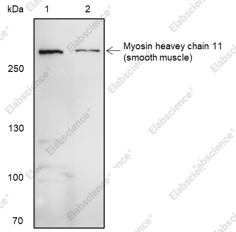 Recombinant Smooth Muscle Myosin heavy chain 11 Monoclonal Antibody - 1
