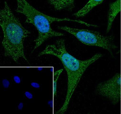 Recombinant Cdc23 Monoclonal Antibody - small - 2
