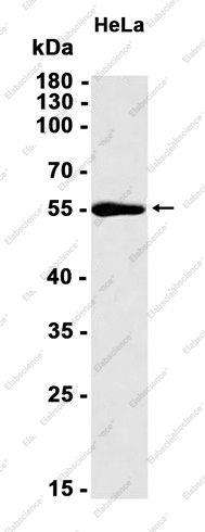 Recombinant Activin Receptor Type IA Monoclonal Antibody - 1