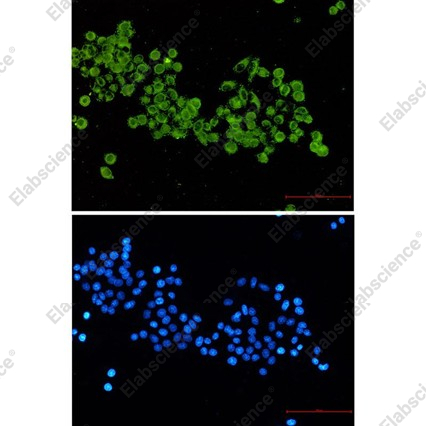 Recombinant Pyruvate Dehydrogenase E2 Monoclonal Antibody - 4