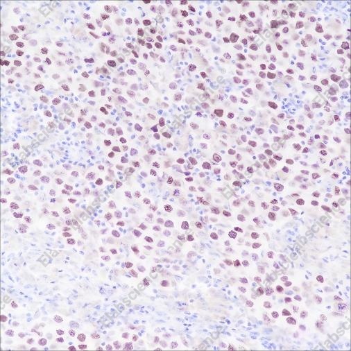 Recombinant SALL4 Monoclonal Antibody - 1