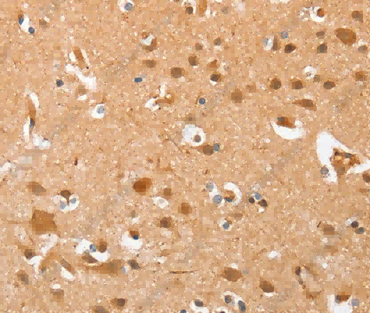AHSG Polyclonal Antibody - 3