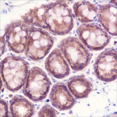 Recombinant MEK2 Monoclonal Antibody - small - 3