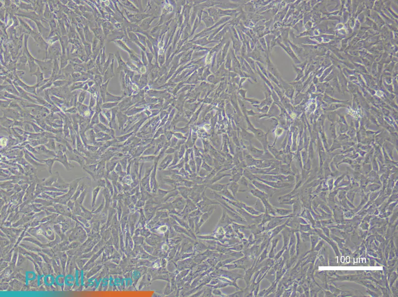 Rat Vascular Adventitial Fibroblast Complete Medium - 1