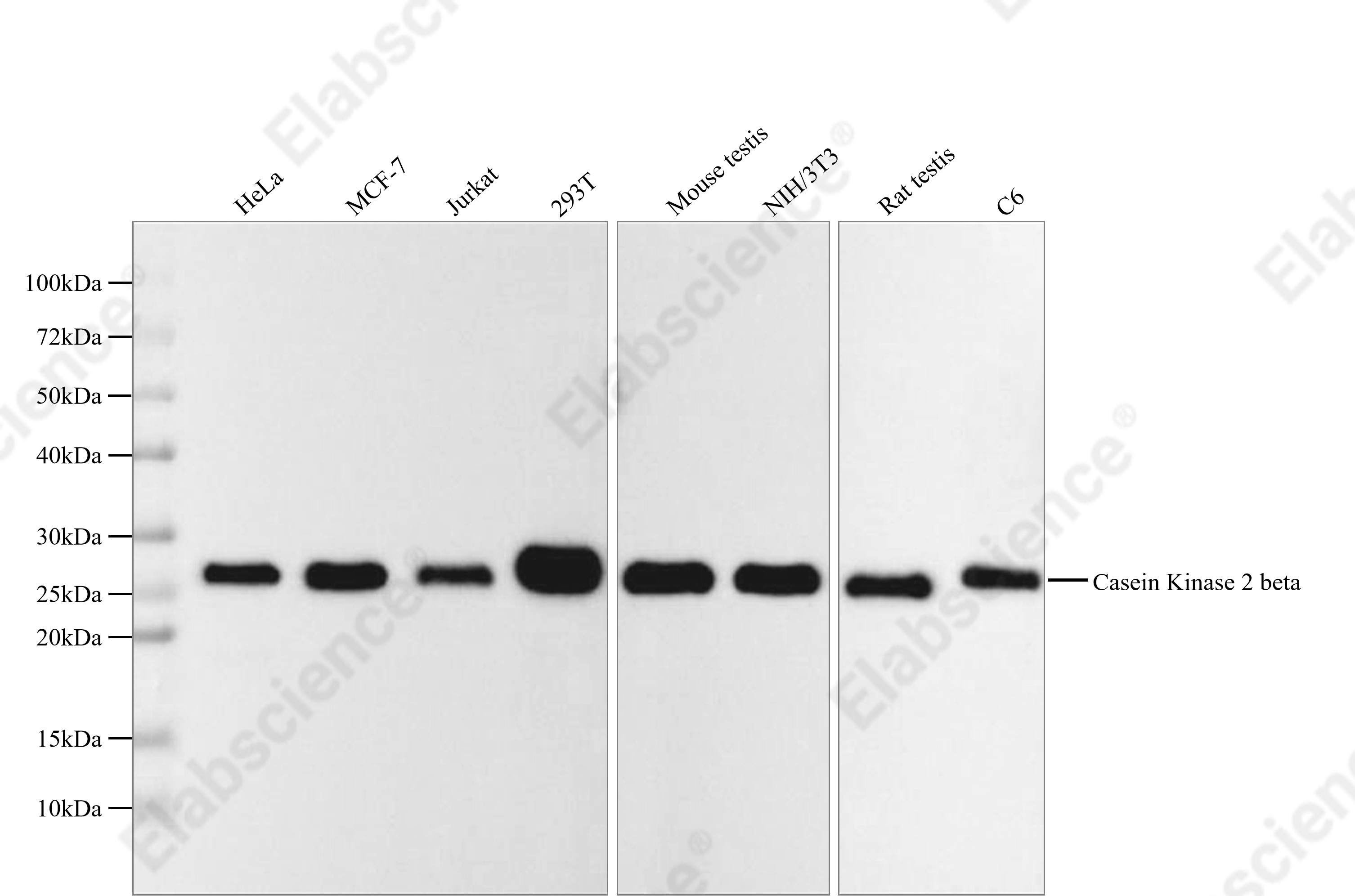 Recombinant Casein Kinase 2 beta Monoclonal Antibody - 1