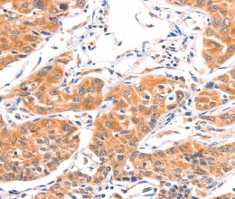 AMPD1 Polyclonal Antibody - 3