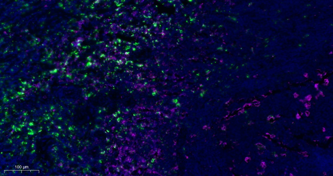 Recombinant CD68 Monoclonal Antibody - small - 5