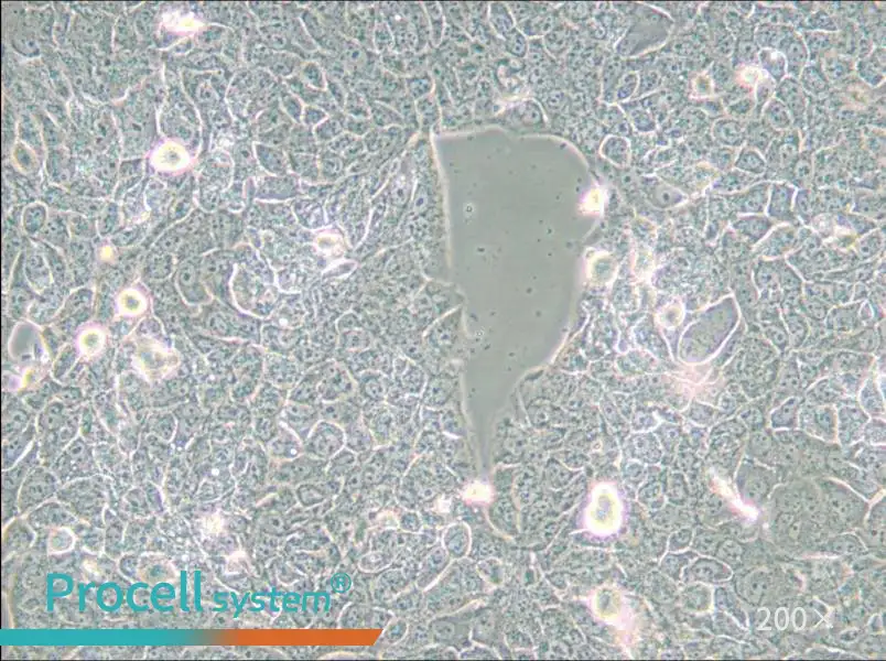 NCI-H2228 [H2228; H-2228] Cell Complete Medium - small - 5