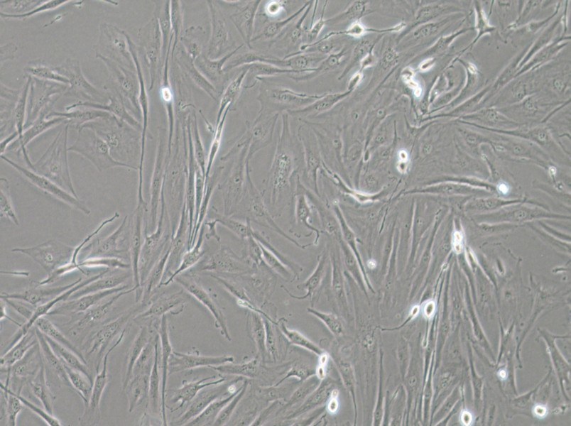 FTC-133 Cell Complete Medium - 2
