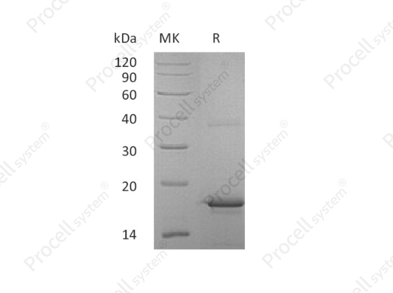 IL-33/IL-1F11, Human, Recombinant