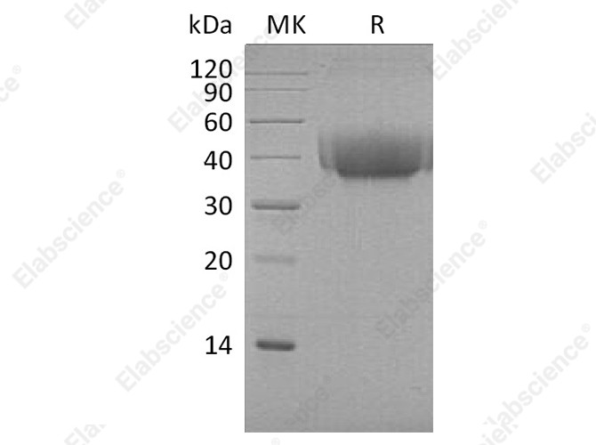 Recombinant Cynomolgus B7-1/CD80 Protein (His Tag) - 1