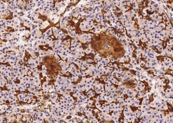 ENO2 Monoclonal Antibody - 2
