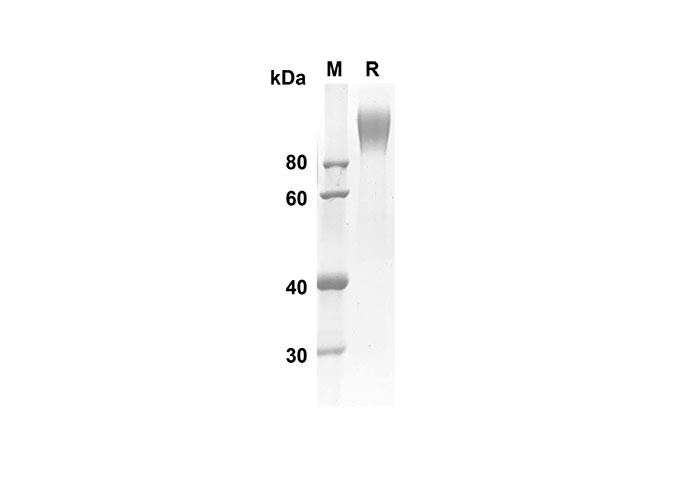 Recombinant Human BTN3A1/CD277 Protein(His Tag)-产品推荐-1