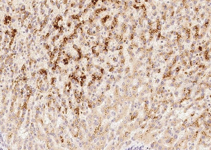 Protein HC/Bikunin Monoclonal Antibody-searchlist-1