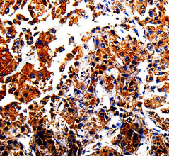 AFP Polyclonal Antibody - 3