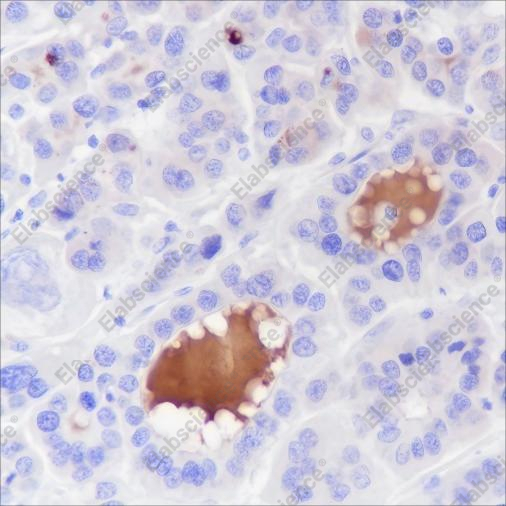 Recombinant Complement C4-B Monoclonal Antibody - 3