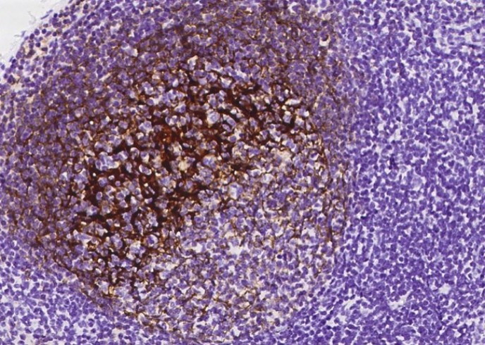 CD21 Monoclonal Antibody - small - 4