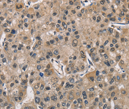 PGK1 Polyclonal Antibody - 2