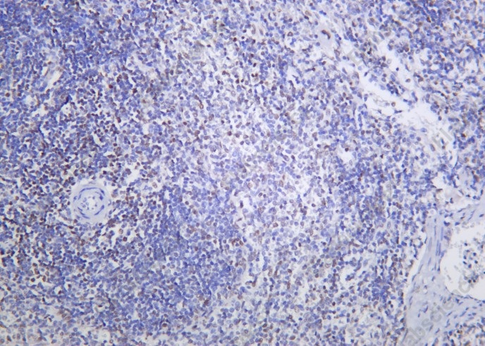 Recombinant Dnmt3a Monoclonal Antibody - 2