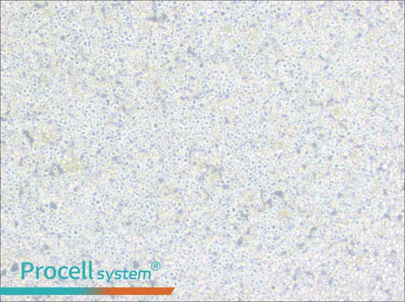 PC 61 5.3 [PC 61; PC 61.5.3] Cell Complete MediumPC 61 5.3 [PC 61; PC 61.5.3] Cell Complete Medium - 3