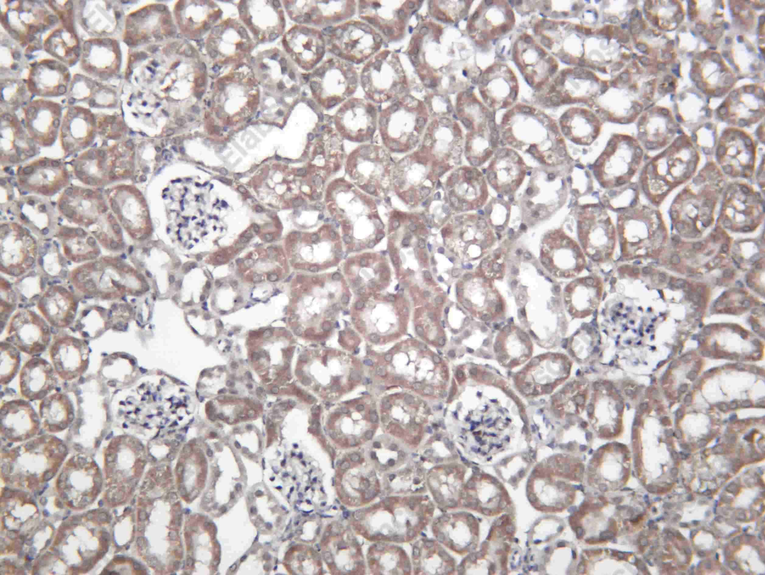 Recombinant KDM5A Monoclonal Antibody - 2