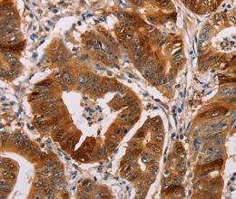 ALDH3A1 Polyclonal Antibody - 2